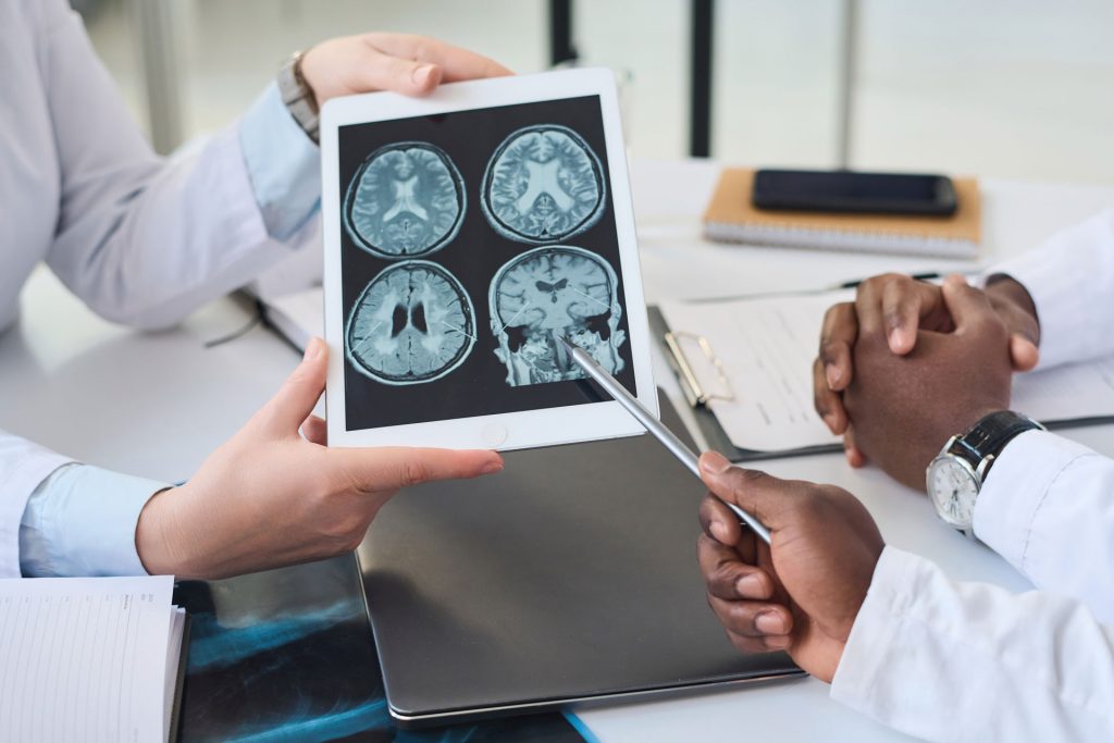 Doctor discussing ischemic stroke through a CT scan.