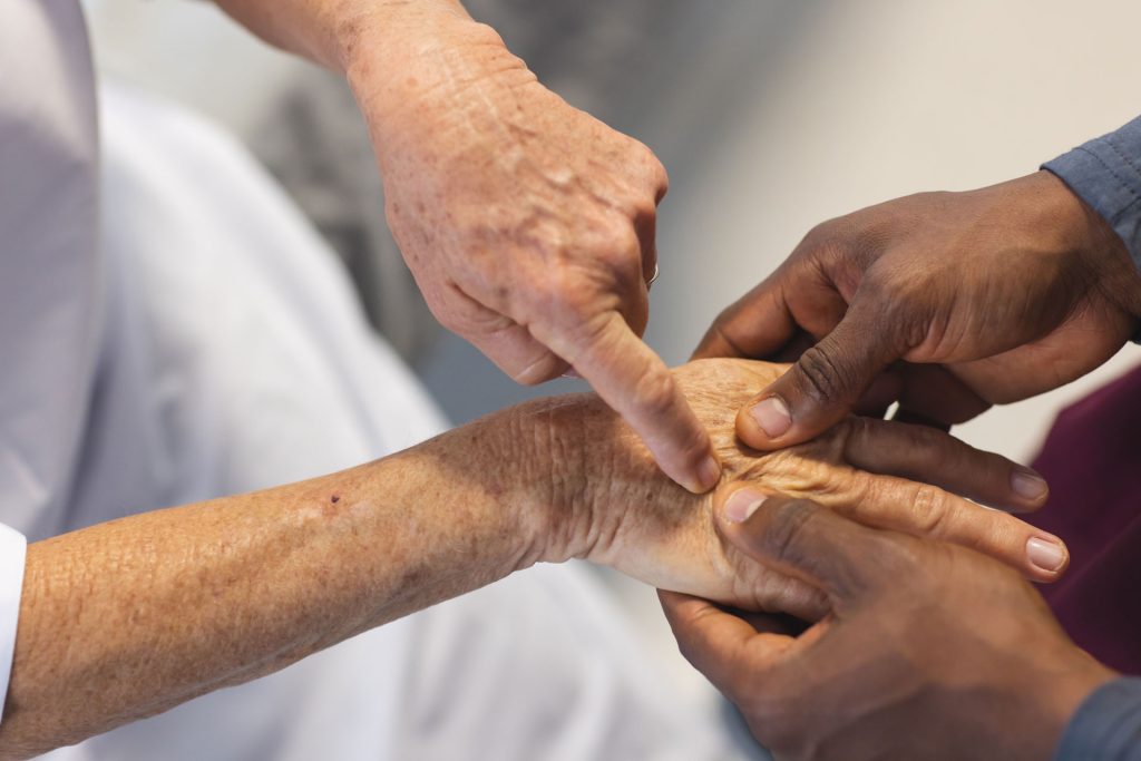 Close up photo of an elder hand with essential tremors.